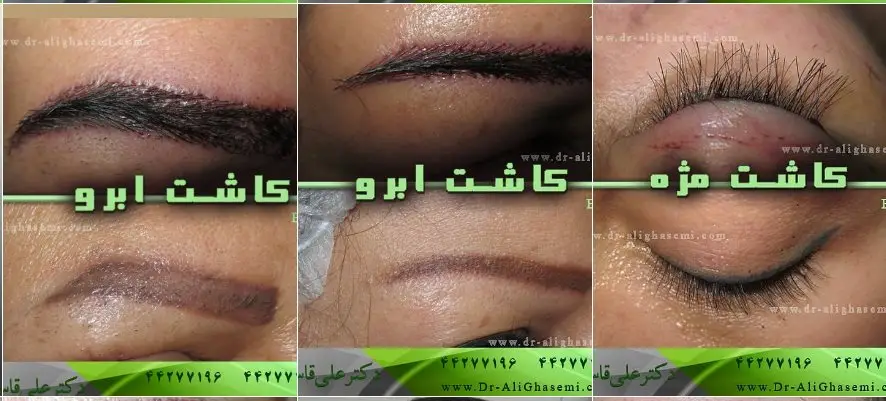 نمونه کار کلینیک دکتر علی قاسمی