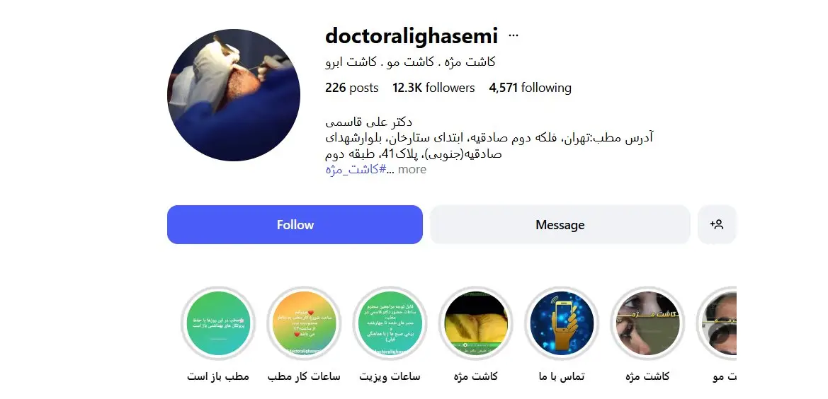 کلینیک دکتر علی قاسمی؛ دقت و ظرافت در کاشت مژه